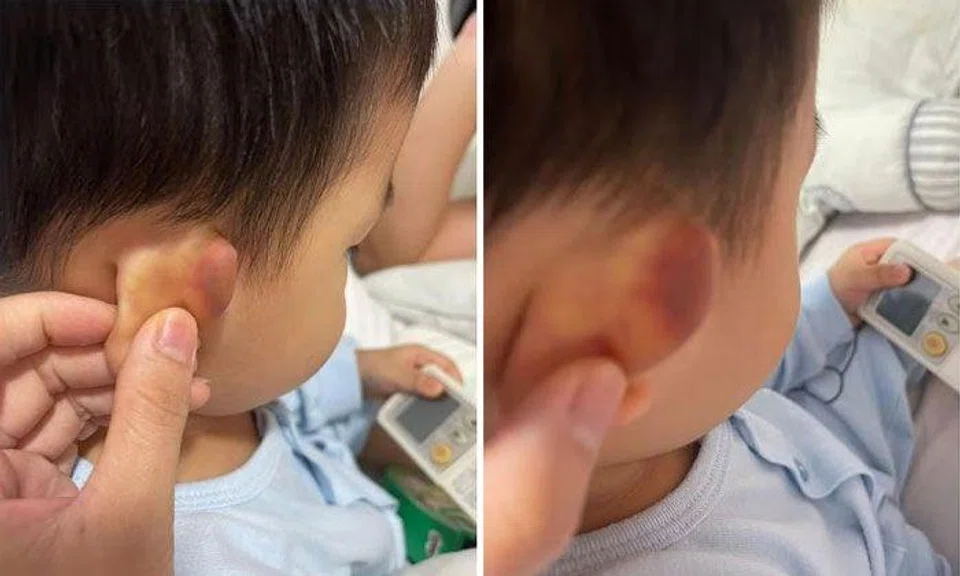 Yishun pre-school teacher used 'inappropriate method' to push child away from window: ECDA