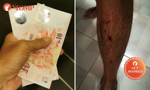 Deliveroo rider touched to get $20 tip and help from kind strangers after accident during heavy rain