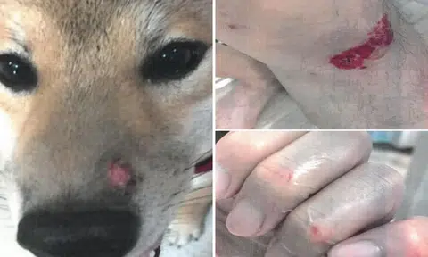 Man fined $4,500 after unleashed, unmuzzled bull terrier attacks shiba inu and drags its owner