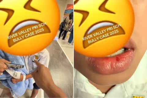 'He could've become a vegetable': Father alleges son was punched at River Valley Primary; school disputes account