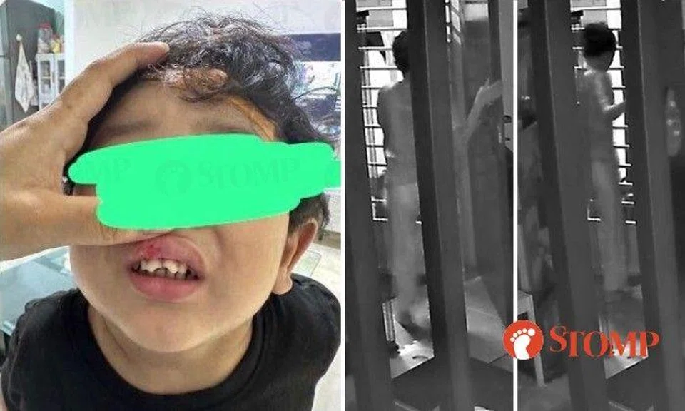 Boy broke front teeth under care of maid who runs away after 1½ months, leaving mum of 4 in lurch