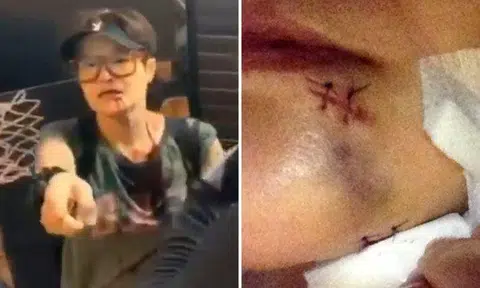 TVB actress Celine Ma receives 11 stitches after getting attacked by protesters in Hong Kong