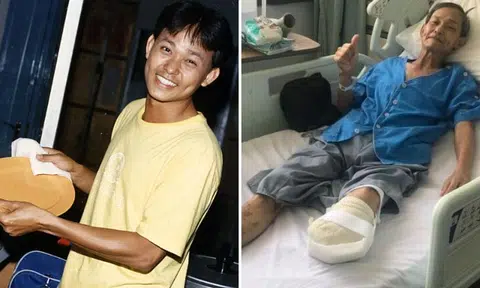 'Ah Cai' actor: 'I thought I was strong and would accept the loss of my leg in a day or two'