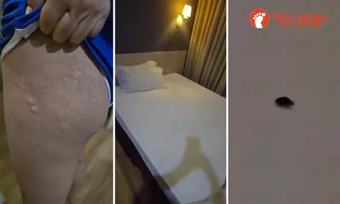 Woman in JB hotel can't sleep due to itch, wakes up with bites and finds bed bug crawling on sheet