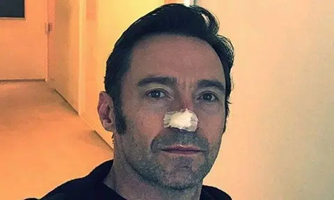 Hugh Jackman treated for skin cancer for the sixth time