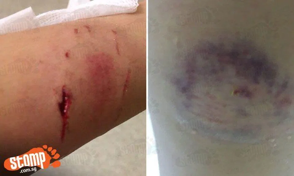 Yet another monkey attack at Segar Rd, this time more vicious: Block 471 resident left with huge gash and bruise