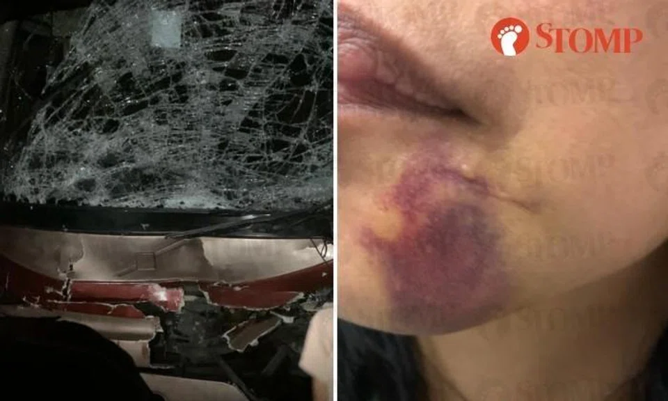 Family hurt in crash on ride from Golden Mile to Ipoh, but bus company allegedly didn't care: Passenger