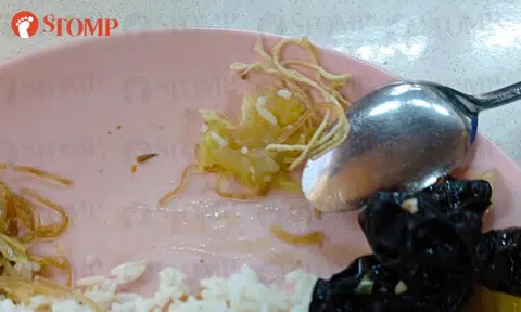 Diner finds rope in economy rice from Kallang stall: 'They deserve a warning'