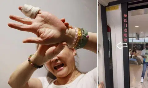 A woman’s little and ring fingers were fractured after they were caught between an MRT train door and the train wall. Photo: Shin Min Daily News
