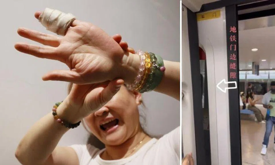 A woman’s little and ring fingers were fractured after they were caught between an MRT train door and the train wall. Photo: Shin Min Daily News