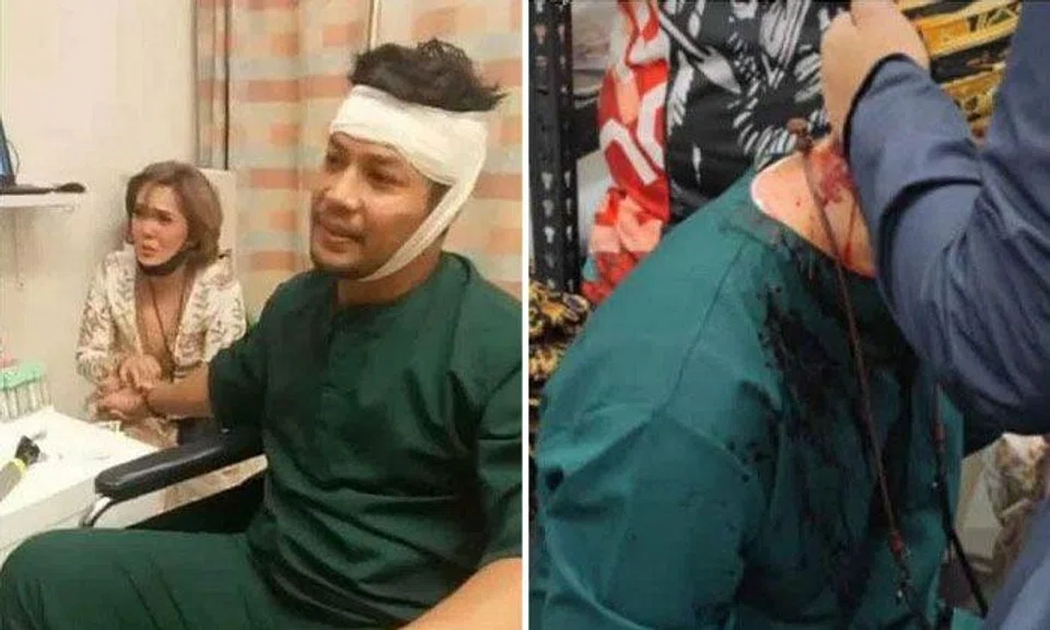 Malaysian actor Kamal Adli, seen with his wife, actress Uqasha Senrose, was rushed to Changi General Hospital and received four stitches after he was attacked by a man with a baton. PHOTOS: ROSLAN SHAH, INSTAGRAM