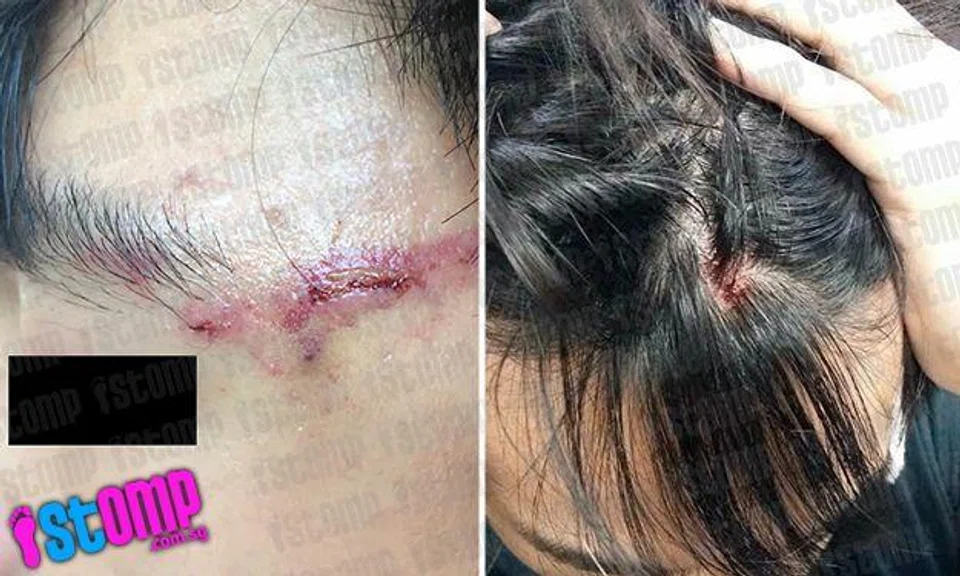 Alleged bullying at ITE College Central: Student tries to hit youth with hockey stick, then punches him over dispute