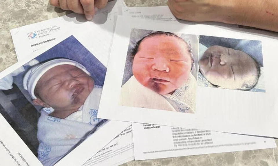 "Shortly after birth, a nurse noted red marks on the baby’s face, which by evening had turned into bruises," 