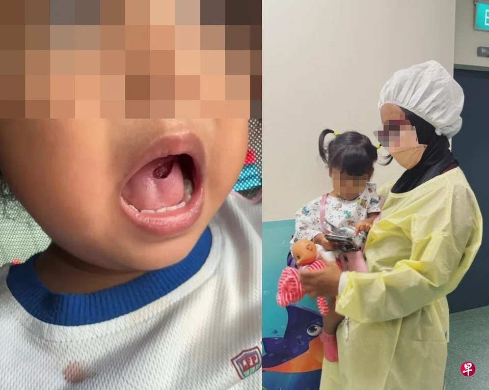 Ms Renny Izzatie took to social media to express her dissatisfaction with how the preschool handled her daughter’s accident.