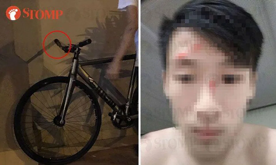 Appeal for witnesses: Cyclist wakes up along Tampines Ave 10 with injuries to face and no recollection of what happened