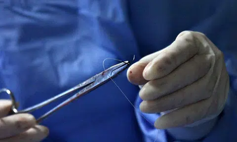 M’sian boy awarded $113,371 after botched circumcision in Terengganu