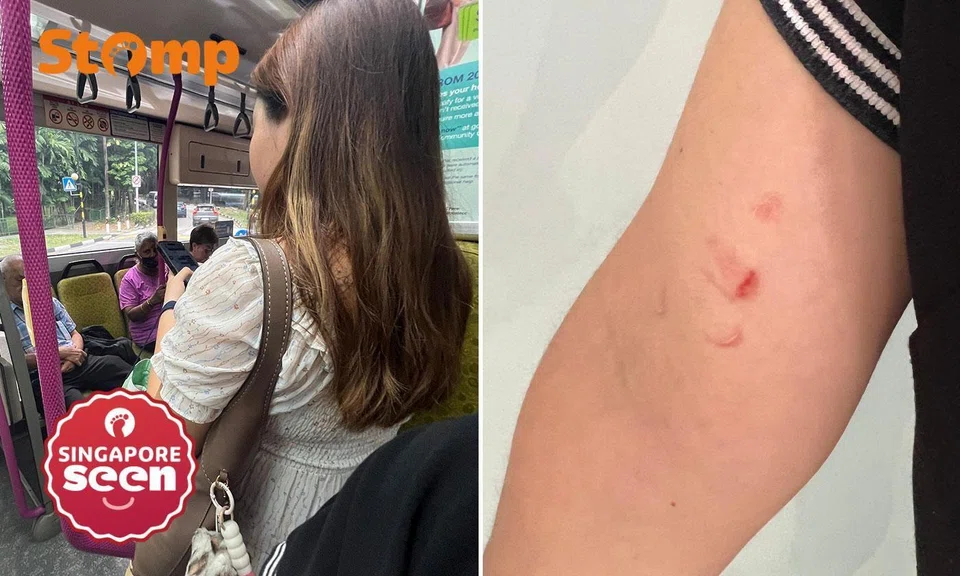 Woman scratches mum with baby after stomping on her foot in bus
