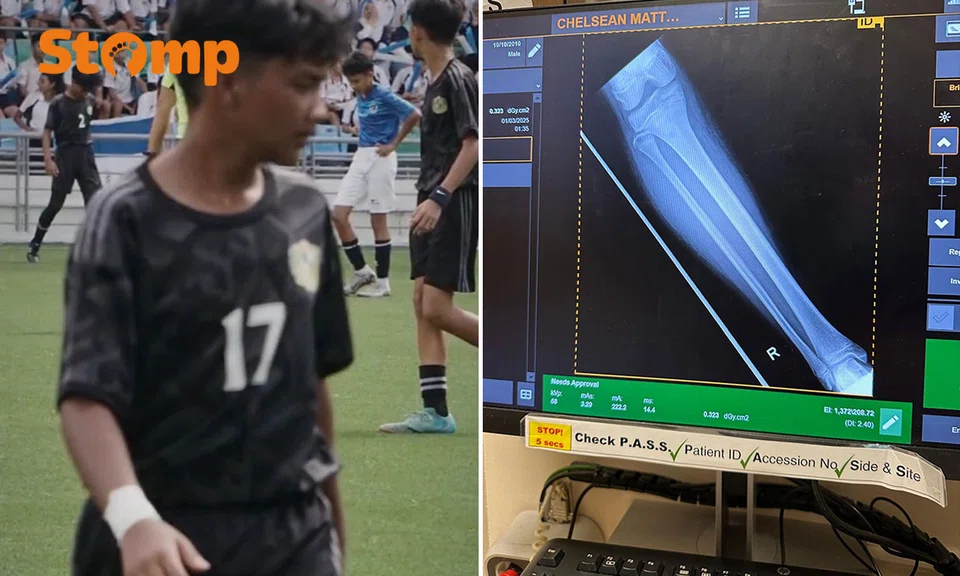 Chelsean (left) before his injury. PHOTOS: STOMP