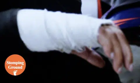 Foreign worker hurts hand while moonlighting, claims $5k compensation from Stomper's company