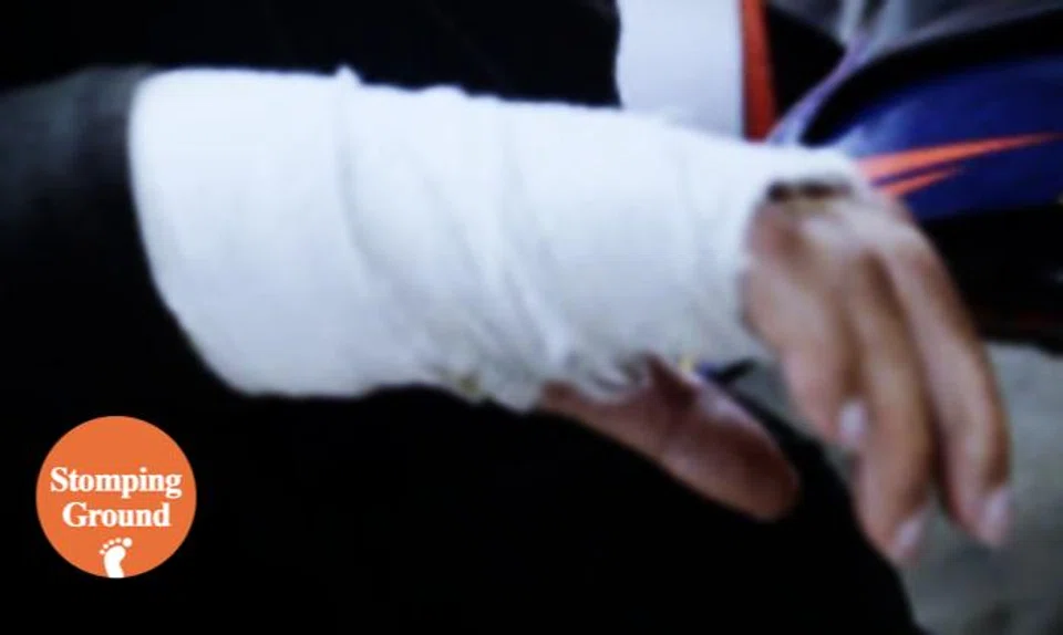 Foreign worker hurts hand while moonlighting, claims $5k compensation from Stomper's company