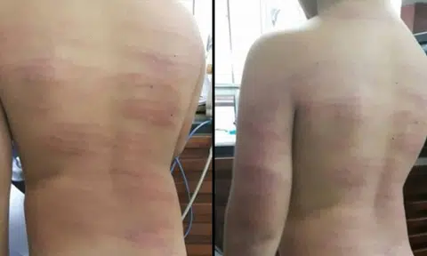 Thai teacher canes 7-year-old student 99 times for requesting an early dismissal