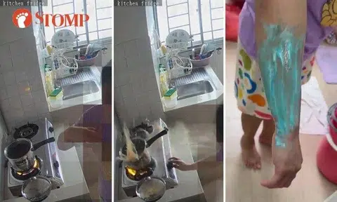 Gas burner 'erupts' and splashes pot of hot soup on maid's arm, Aerogaz investigating cause