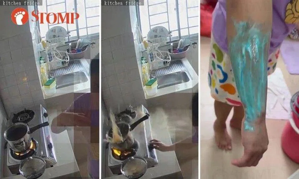 Gas burner 'erupts' and splashes pot of hot soup on maid's arm, Aerogaz investigating cause