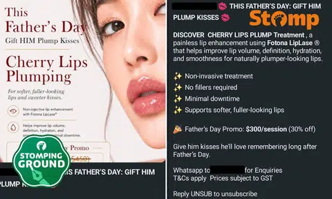 Stomper slams clinic’s cringey Father’s Day ad about ‘plump kisses’