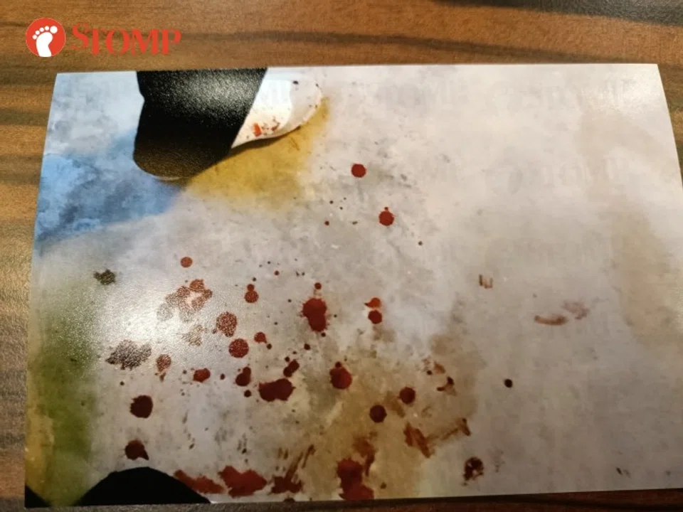 The Stomper's father was taken to hospital