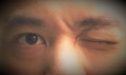 Man suing plastic surgeon over eyelid operation is an 'evasive witness', says judge dismissing case