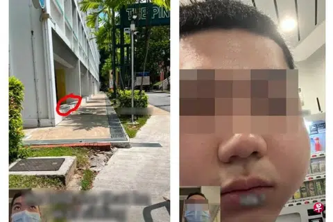 The victim first met the man outside an HDB carpark (left), before being assaulted. His left cheek was visibly swollen from the punch (right).