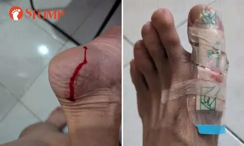 Segar Road resident hurt after slipping on floor wet from neighbour's air-con