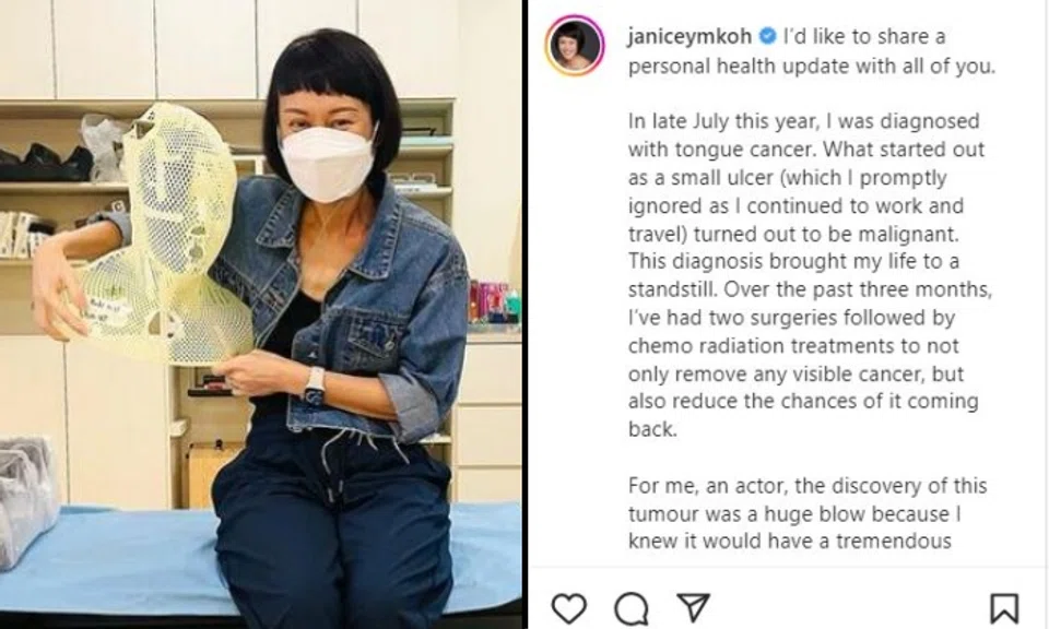 Koh, 48, wrote in a post on Instagram on Saturday that she was diagnosed with tongue cancer in late July.
