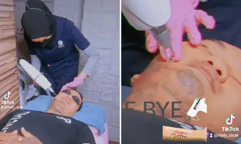 Ex-convict who turned life around after becoming Foodpanda rider now undergoes painful tattoo removal