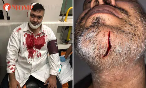 Man jailed for cutting cabby with flip knife at Orchard Towers