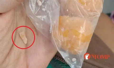 "It was a shard, like a sharp bone or something," said the Stomper.