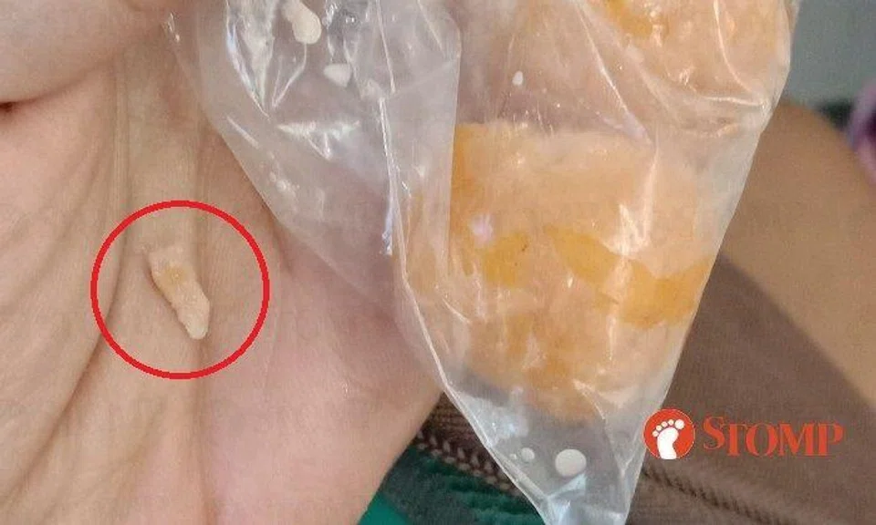 "It was a shard, like a sharp bone or something," said the Stomper.