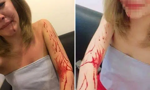 Woman who claimed Bangkok cabby robbed her admits to lying, wounds were self-inflicted