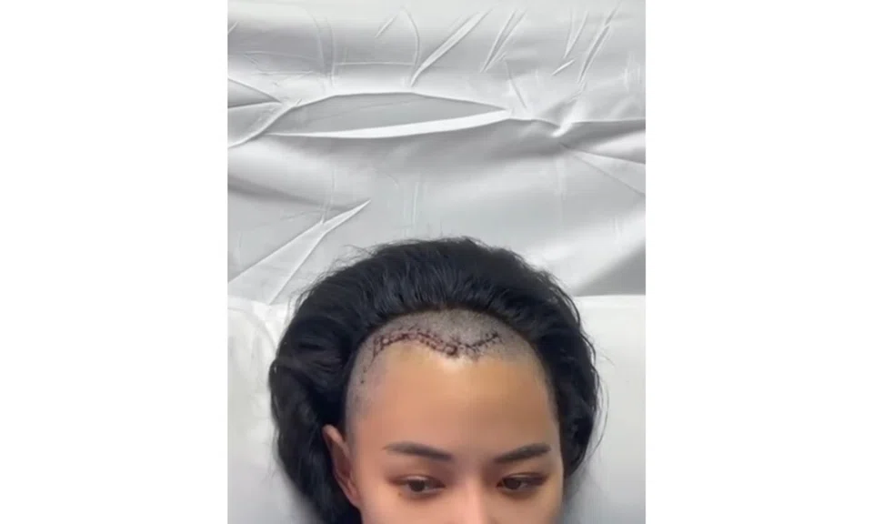 ex-SQ stewardess incurable brain cancer marriage