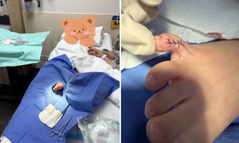 Mrs Hong Yu took her daughter to Mount Elizabeth Hospital, where the girl got stitches.