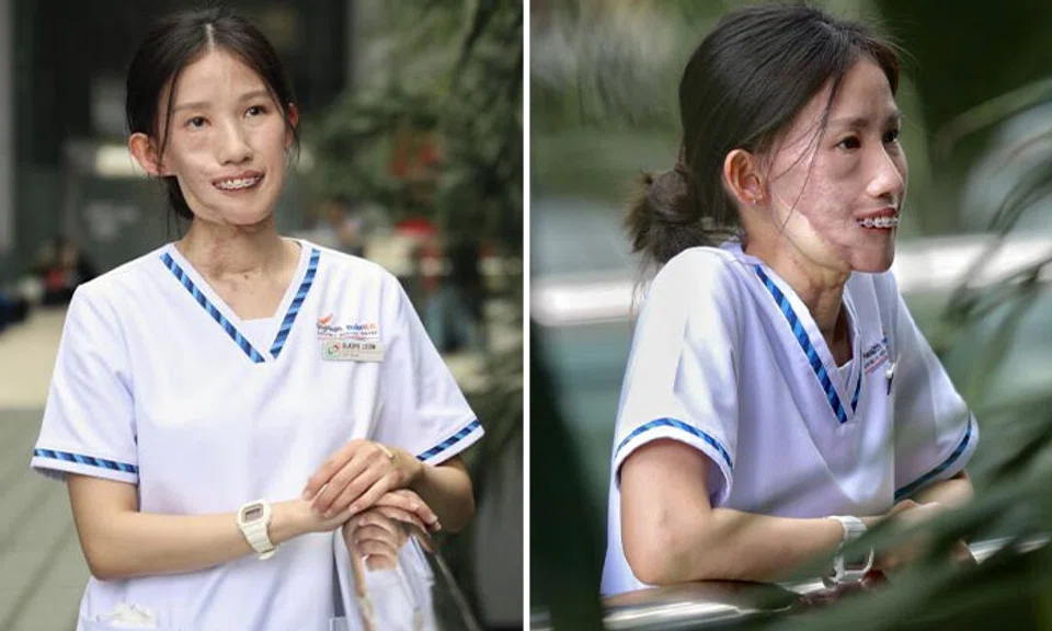 Ms Gladys Leow was 18 when she discovered that she had liposarcoma, a rare cancer that develops from fat cells. ST PHOTO: TARYN NG