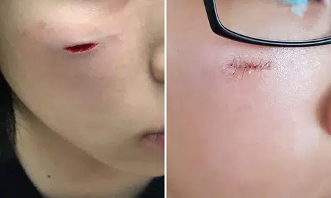 Girl, 14, gets stitches after suffering cut to face at Jewel's Canopy Park mirror maze