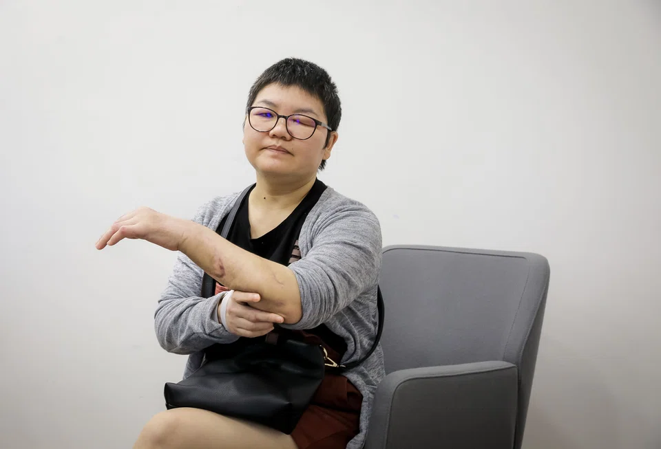 Ms Han Hongli, whose left hand was almost severed during the attack, is now blind in her left eye. Her face is permanently disfigured, and the functioning of her arms is impaired. The tip of her right ring finger was also amputated.