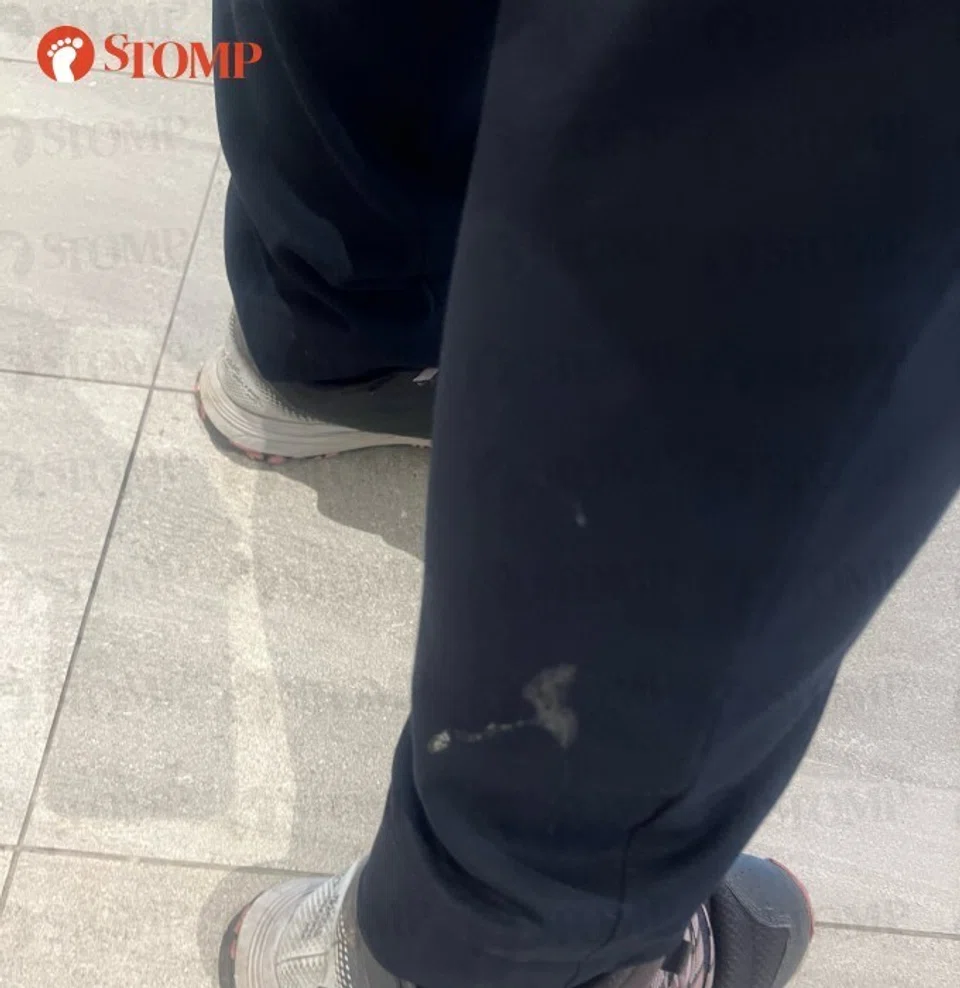 mucus on pants