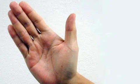 Man slaps 4-year-old in Woodlands