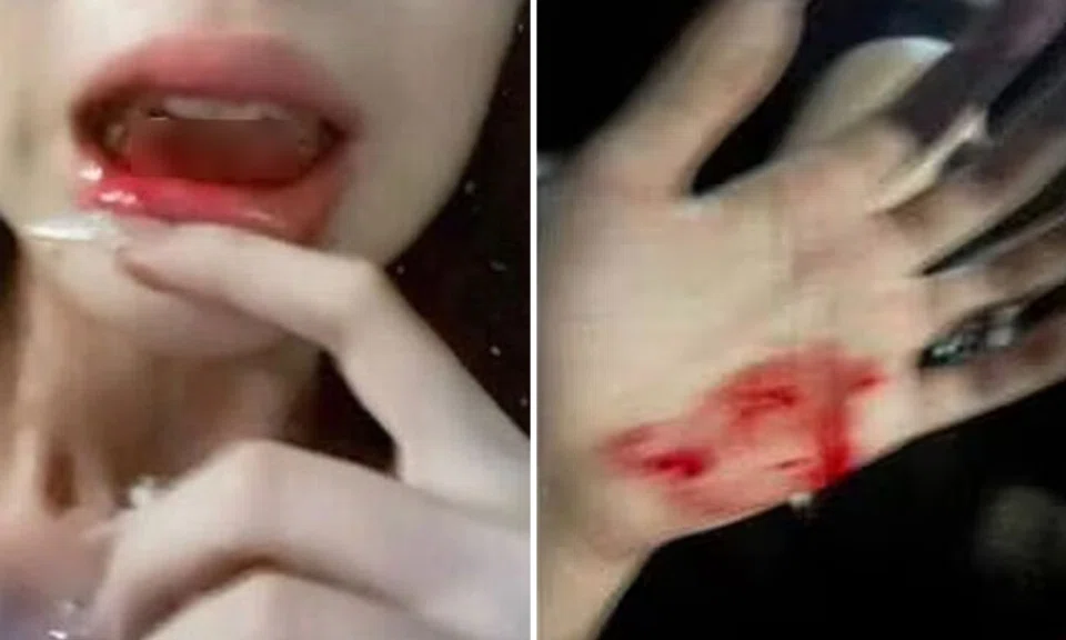 The woman interviewed claimed that she was beaten so hard that her mouth was full of blood and that her teeth were almost loose. PHOTO: LIANHE ZAOBAO