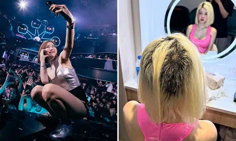 South Korea's DJ Soda left with bald patches after her hair 'melted from the roots' during bleaching session