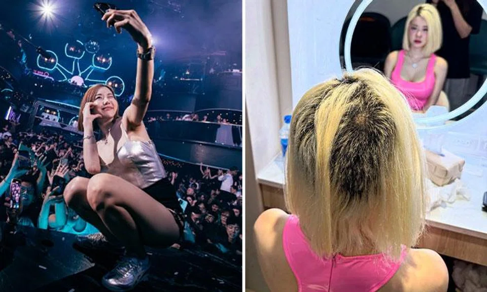 DJ Soda said her hair kept coming out in big handfuls daily.