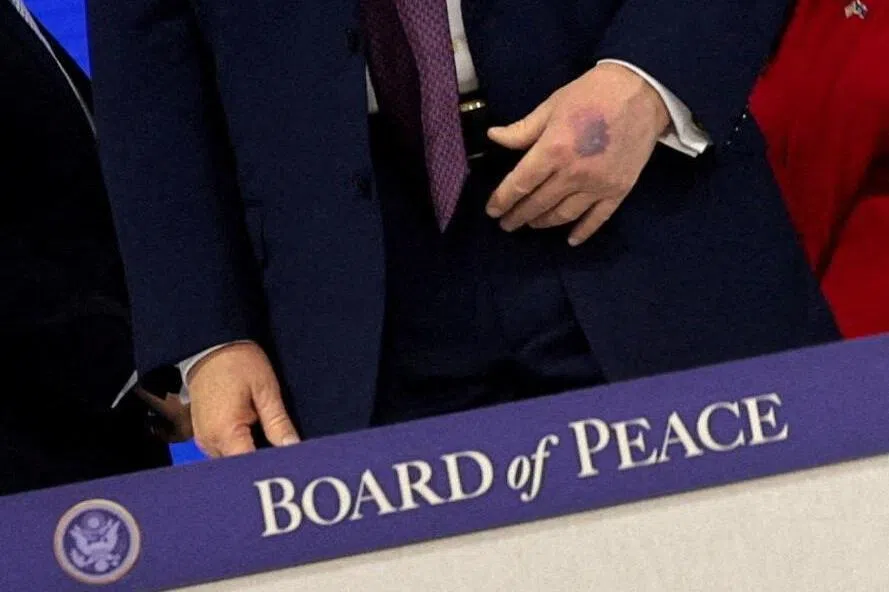The images of Mr Trump's bruised left hand, taken while he was at an inaugural ceremony for his global “Board of Peace” initiative, quickly spread on social media.