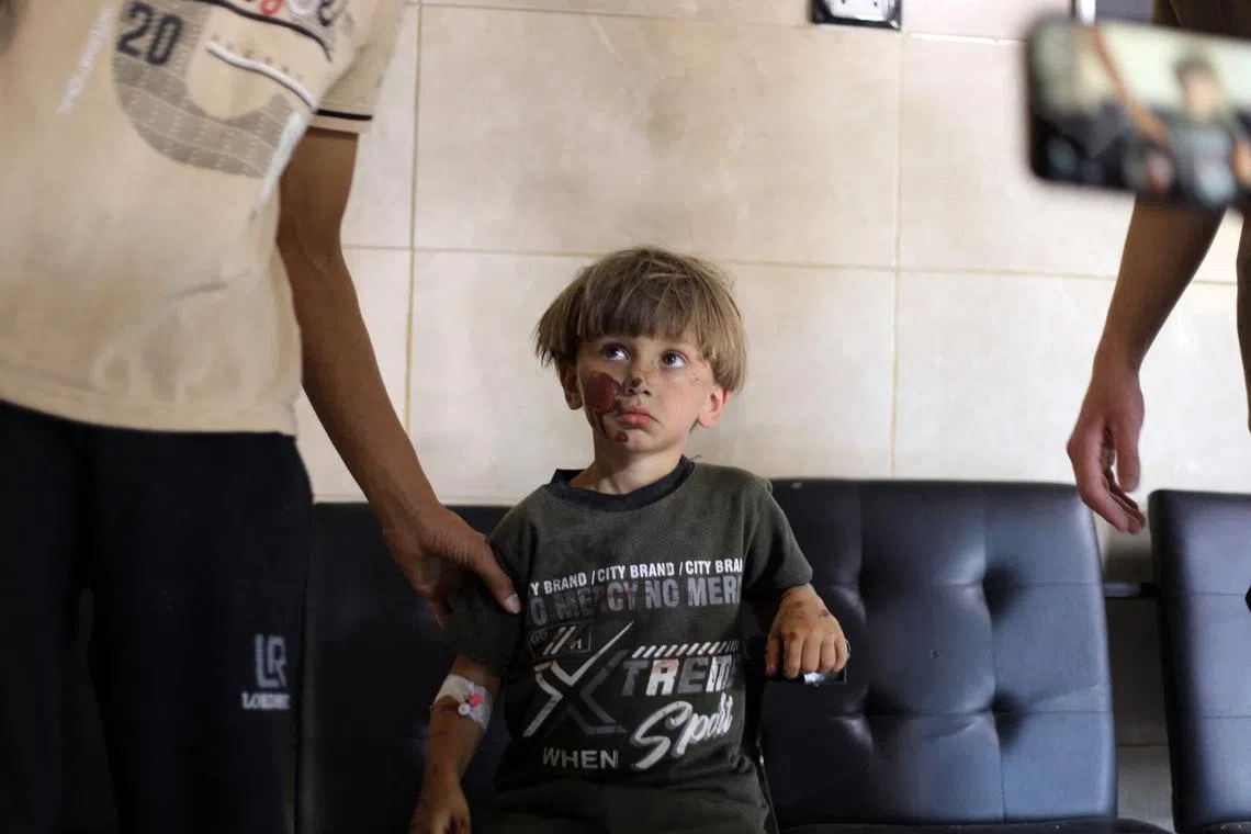 An injured child waiting for medical attention at a hospital on July 24, following an explosion in Maarrat Misrin in the northern part of Syria's Idlib governorate.